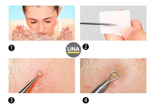 Kit Extractor de Espinillas - ClearSkin